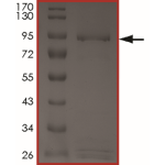 EGFR (d747-752 P753S), Active